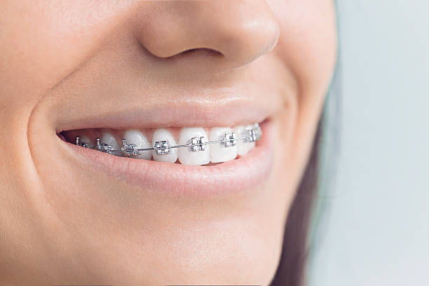 Best Sealants  in Craigsville, WV